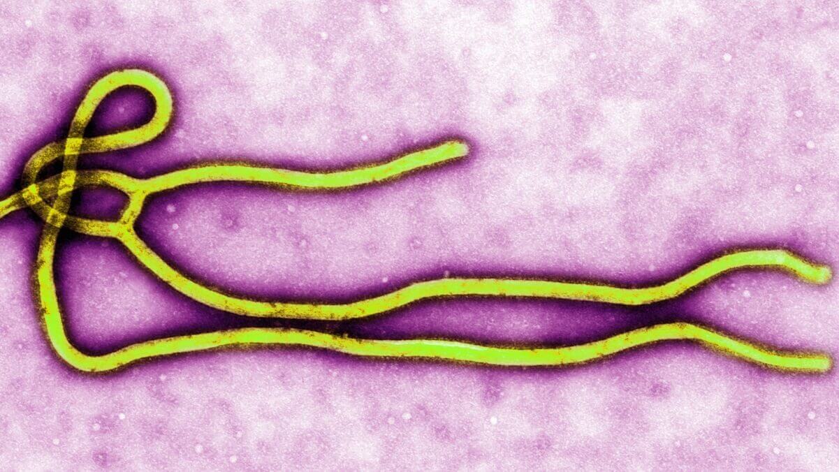 埃博拉病毒卷土重来:有些病毒永远不会真正消失