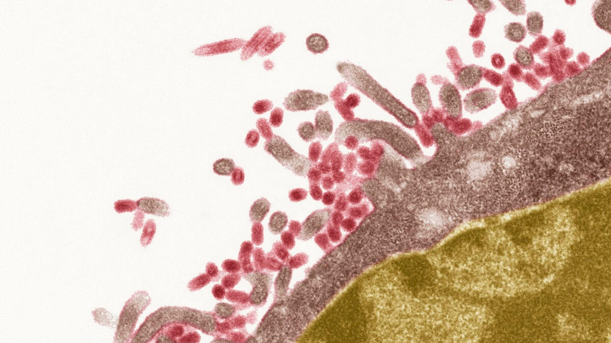 新冠肺炎疫情是否导致流感病毒灭绝?