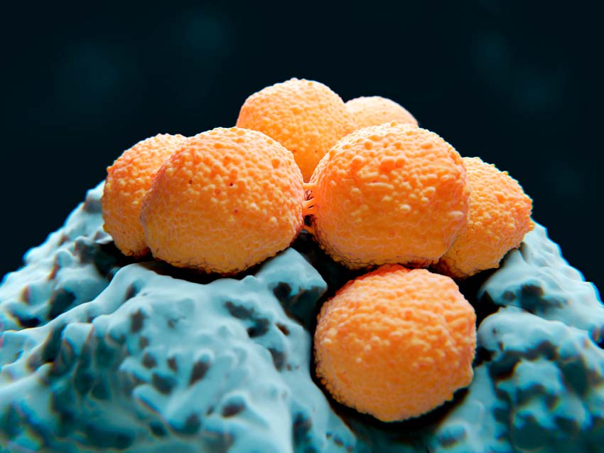 链球菌显微照片